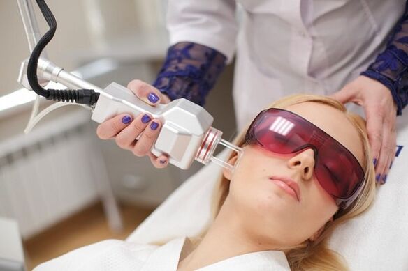A facial laser rejuvenation