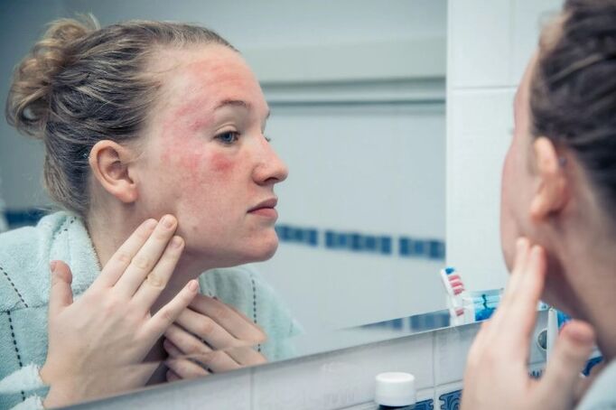 Chronic skin disease at stage of deterioration