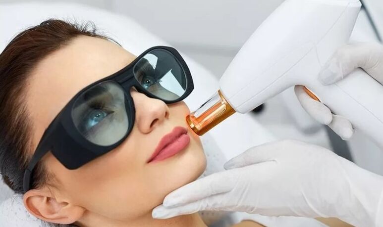 Skin laser rejuvenation