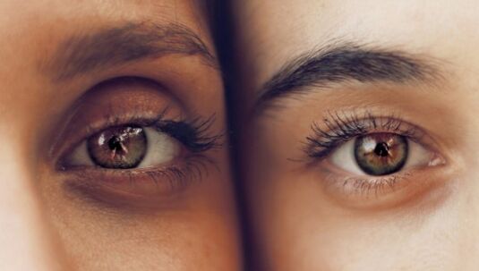 The dark circle under the eyes