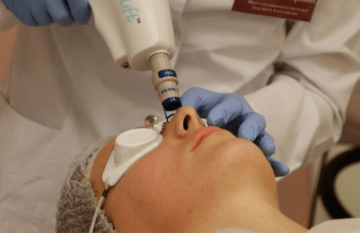 Laser rejuvenation that cannot be
