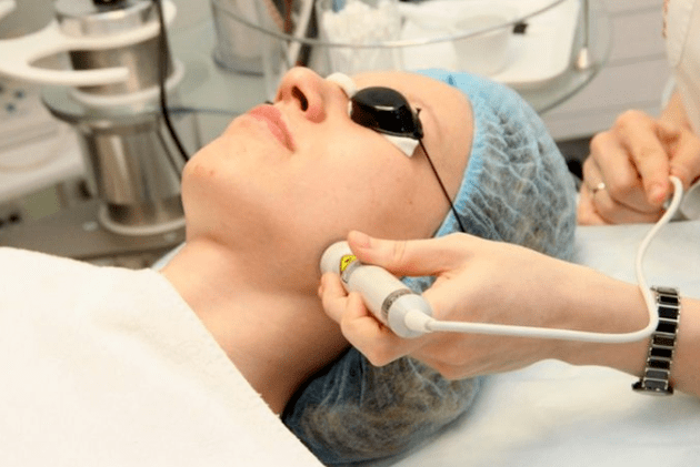 Laser's biorevitalization