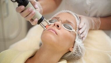Fractional type of facial skin rejuvenation