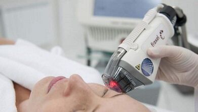 How is fractional skin rejuvenation done